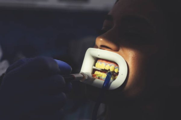 Laser light lamp turn on as a procedure of professional teeth whitening. Women's cosmetic and aesthetic dental care health concept. Closeup, wallpaper picture. Concept of teeth whitening and oral hygiene