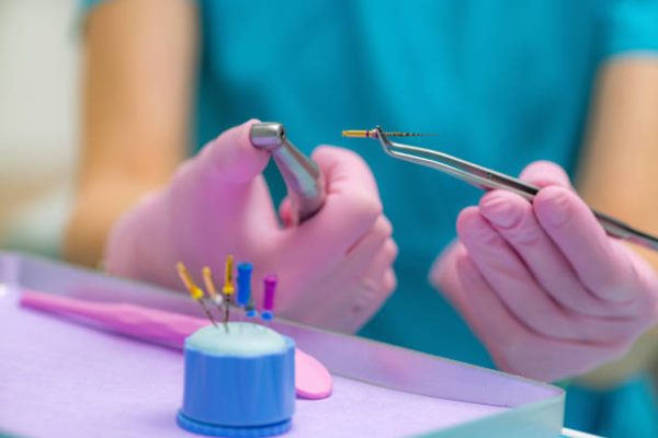 Preparing for Endodontic Root Canal Treatment